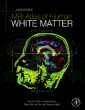 MRI atlas of human white matter