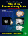 A combined MRI and histology atlas of the rhesus monkey brain in stereotaxic coordinates