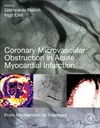 Coronary Microvascular Obstruction in Acute Myocardial Infarction: From Mechanisms to Treatment