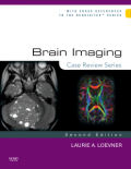 Brain imaging