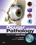 Ocular pathology