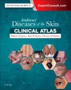 Andrews Diseases of the Skin Clinical Atlas