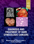 Diagnosis and Treatment of Rare Gynecologic Cancers