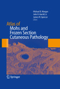 Atlas of mohs and frozen section cutaneous pathology