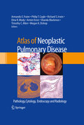 Atlas of neoplastic pulmonary disease: pathology, cytology, endoscopy and radiology