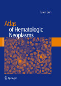 Atlas of hematologic neoplasms