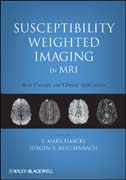 Susceptibility weighted imaging in MRI: basic concepts and clinical applications