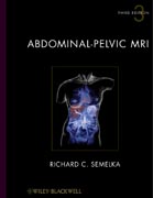 Abdominal-pelvic MRI