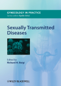 Sexually transmitted diseases