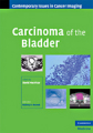 Carcinoma of the bladder