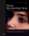 Nasal reconstruction: art and practice