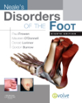 Neale's disorders of the foot