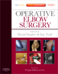 Operative elbow surgery: expert consult - online and print