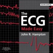 The ECG Made Easy