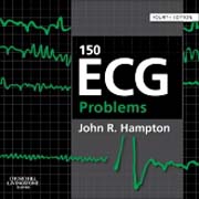 150 ECG Problems