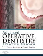 Advanced Operative Dentistry: A Practical Approach