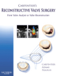 Carpentier's reconstructive valve surgery