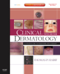 Clinical dermatology: a color guide to diagnosis and therapy