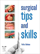 Surgical tips and skills