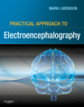 Practical approach to electroencephalography