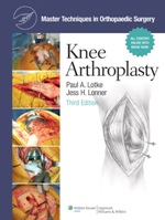 Knee arthroplasty