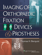 Imaging of orthopaedic fixation devices and prostheses