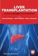 Liver Transplantation