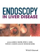 Endoscopy in Liver Disease