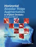 Horizontal Alveolar Ridge Augmentation in Implant Dentistry: A Surgical Manual