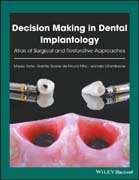 Decision Making in Dental Implantology: Atlas of Surgical and Restorative Approaches