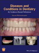 Diseases and Conditions in Dentistry: An Evidence–Based Reference