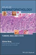 Atlas of Dermatopathology: Tumors, Nevi, and Cysts