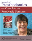 Journal of Prosthodontics on Complete and Removable Dentures