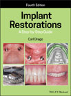 Implant Restorations: A Step–by–Step Guide