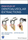 Principles of Dentoalveolar Extractions