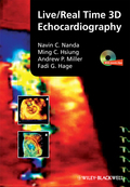 Live/real time 3D echocardiography