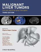 Malignant liver tumors: current and emerging therapies