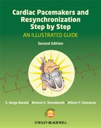 Cardiac pacemakers and resynchronization step by step: an illustrated guide