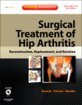 Surgical treatment of hip arthritis: reconstruction, replacement, and revision