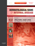 Dermatological signs of internal disease