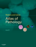 Robbins and Cotran atlas of pathology