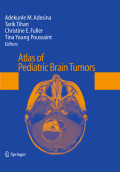 Atlas of pediatric brain tumors