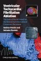 Ventricular tachycardia: fibrillation ablation