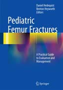 Pediatric Femur Fractures