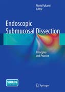 Endoscopic Submucosal Dissection