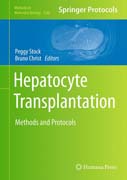 Hepatocyte Transplantation