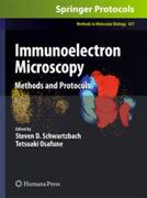 Immunoelectron microscopy: methods and protocols