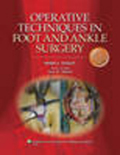 Operative techniques in foot and ankle surgery