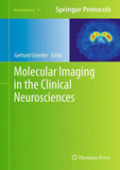 Molecular imaging in the clinical neurosciences