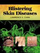 Blistering skin diseases